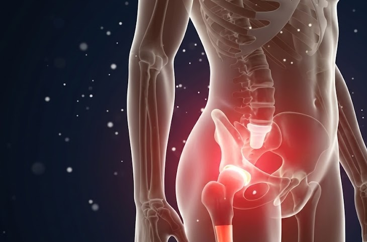 What is Microplasty – Partial Knee Replacement?