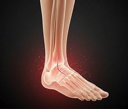 Best Doctors For Ankle Pain Treatment In Ahmedabad