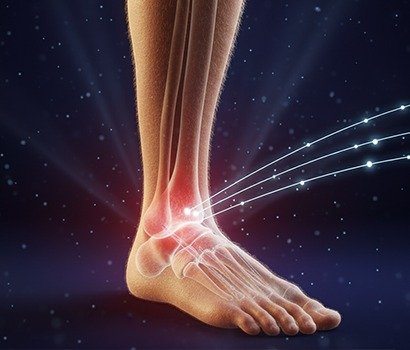 ankle arthroscopy specialist in Ahmedabad