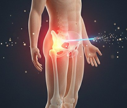 Hip arthroscopy surgery for hip joint pain and mobility improvement in Ahmedabad