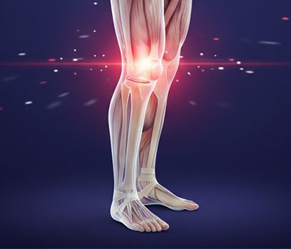 Total Knee Replacement in Sabarmati